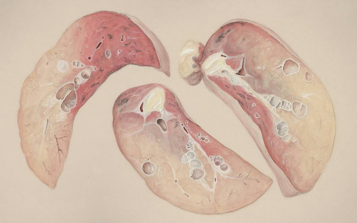 Lung Vitality Technique: 7 Proven Ways to Avoid Costly Breathing Mistakes
